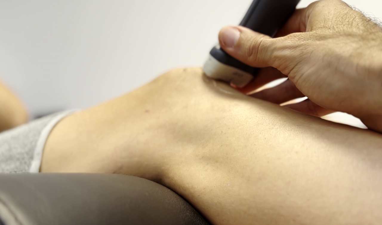 Tecnica-de-estimulacion-periferica-del-nervio-percutaeo-en-clinica-de-fisioterapia-en-alicante-san-blas-