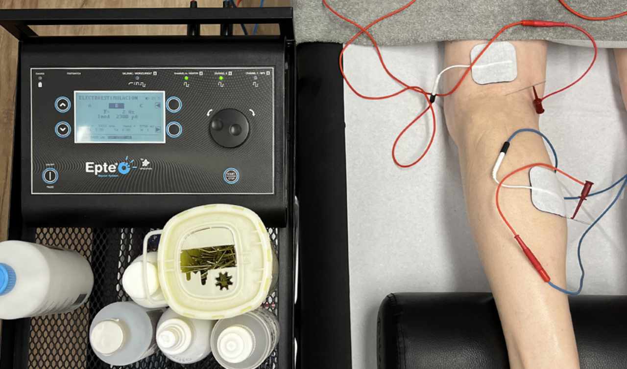 electrolisis-percutanea-en-clinica-fisioterapia-alicante-barrio-san-blas
